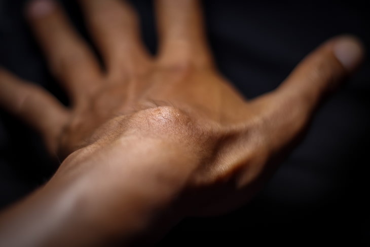 Wrist Pain Causes Carpal boss
