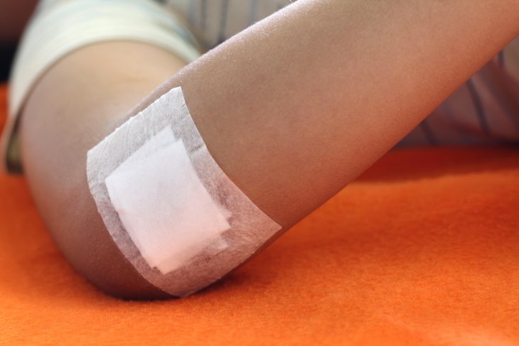 Scarring Prevention band aid on elbow