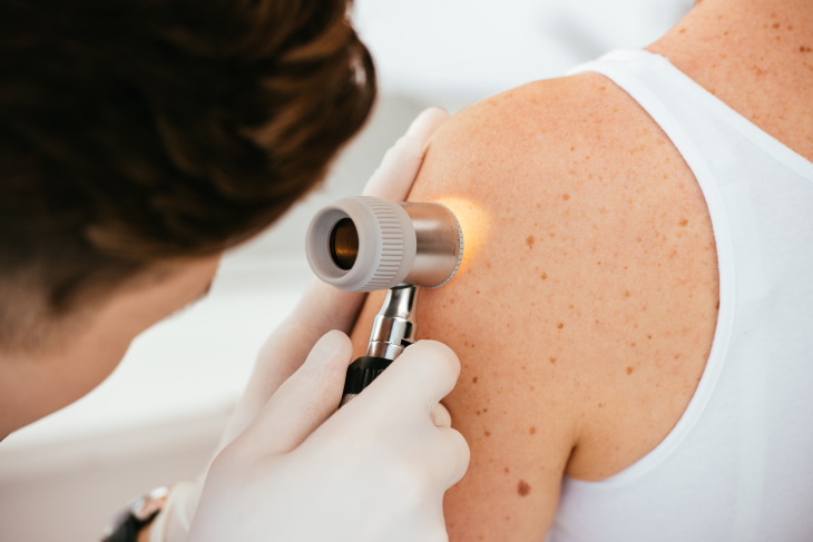 Types of Skin Cancer dermatologist