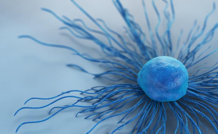 Cervical Cancer cell