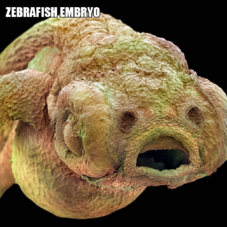 Close-Ups of Bugs & Creatures, zebrafish embryo