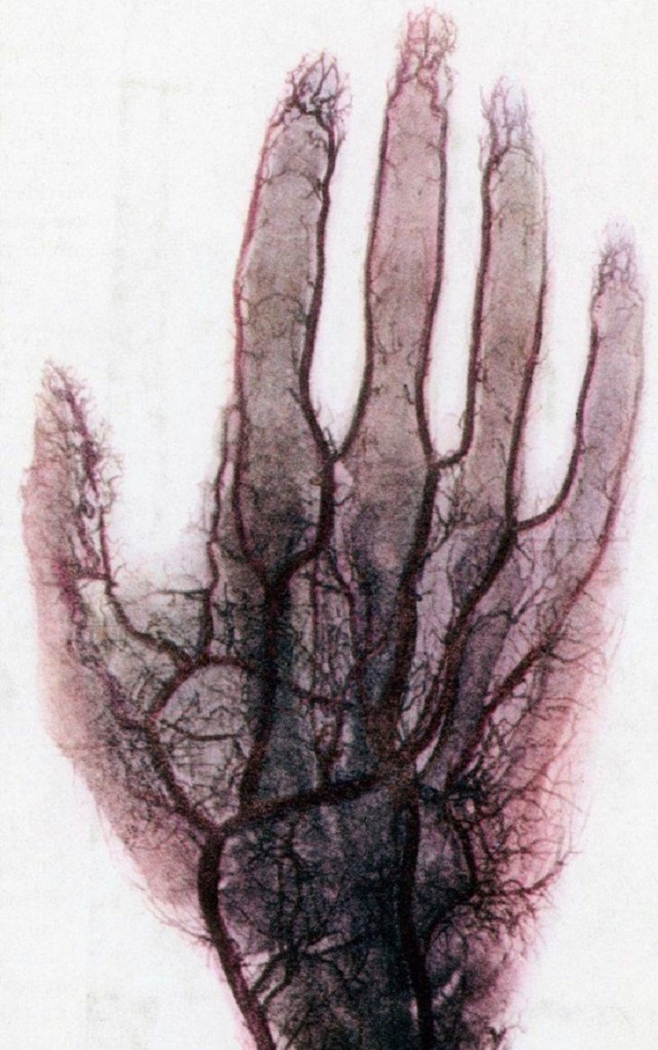 Fascinating X-Rays, Blood vessels