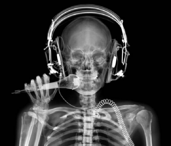 Fascinating X-Rays, skeleton 
