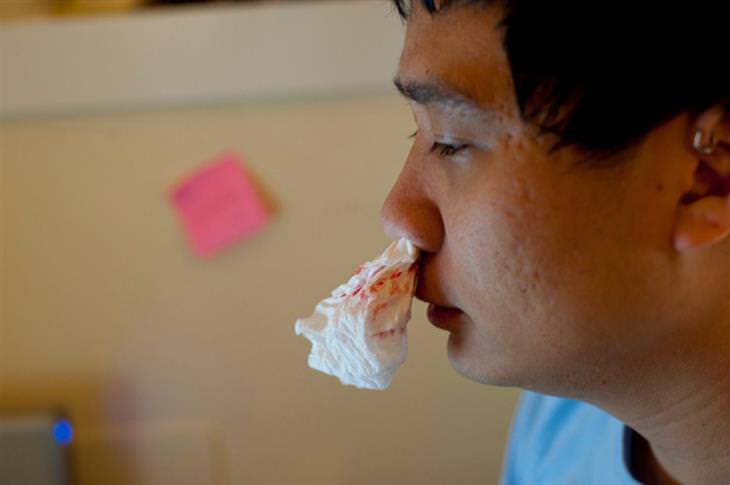 asian man with bloody paper in his nose