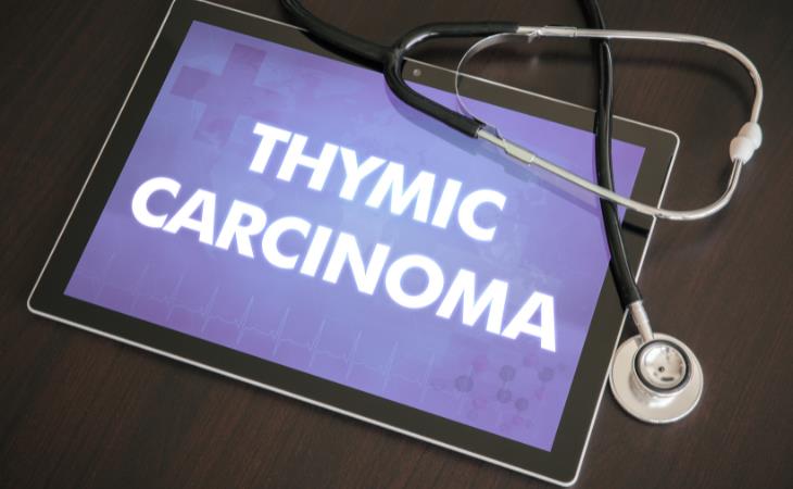 Thymic carcinoma