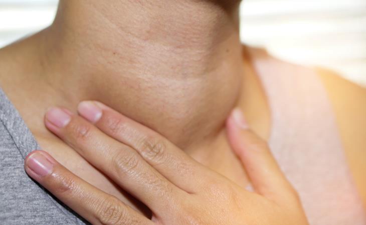 Hyperthyroidism