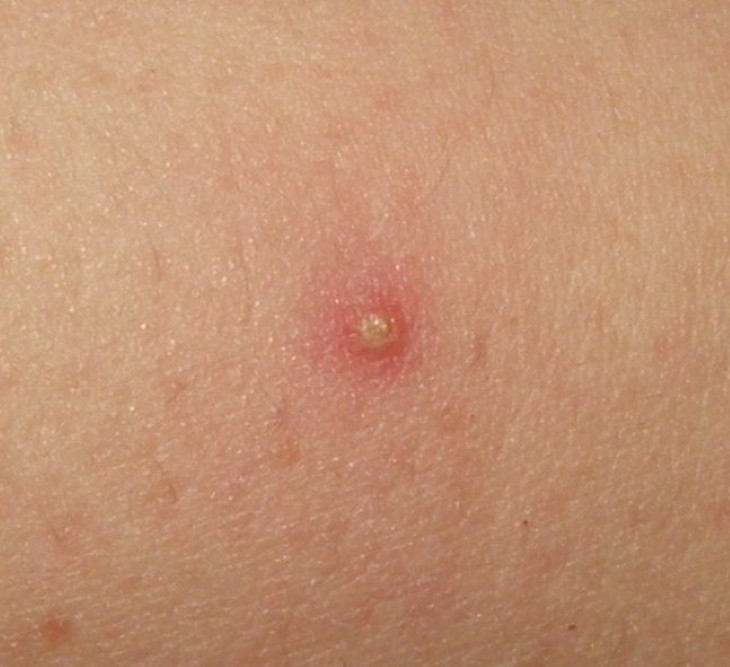 scalp skin conditions