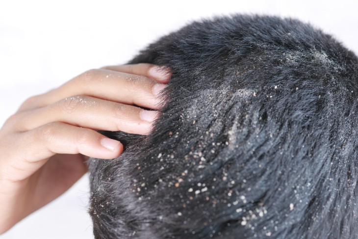 scalp skin conditions