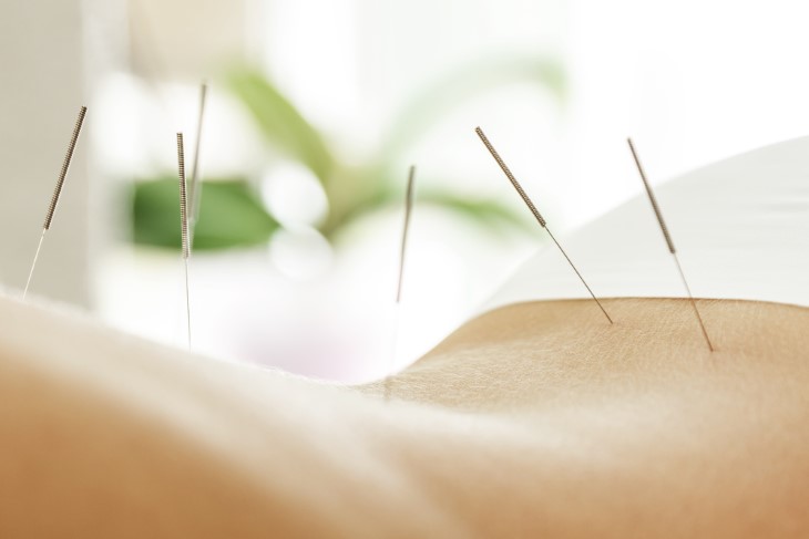 acupuncture and blood pressure