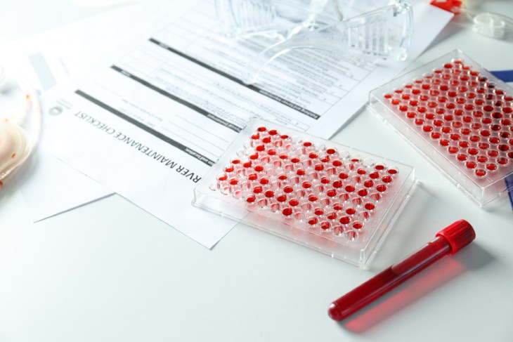 Connecting SIRT6 to Tryptophan Metabolism