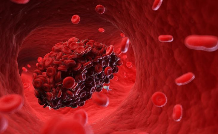 Tips for those taking anticoagulants: a digital illustration of a blood clot