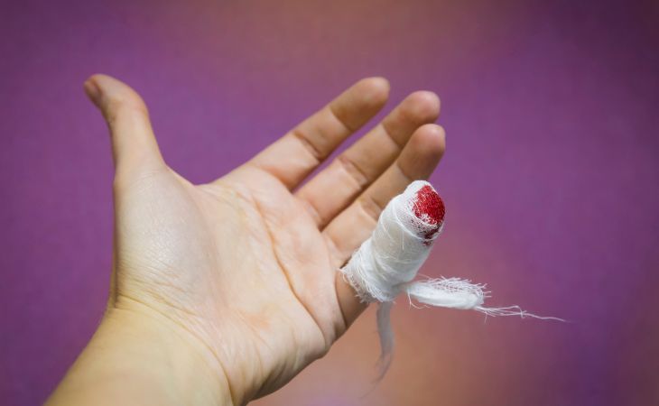 Tips for those taking anticoagulants: a bleeding and bandaged finger