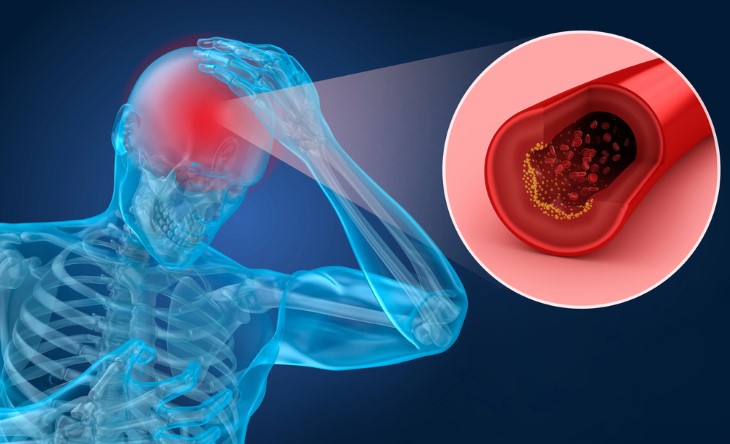 causes of mortality