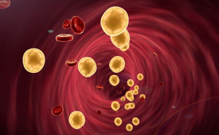 How to Prevent High Cholesterol During Menopause: Cholesterol in the Blood