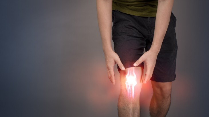 knee arthritis 