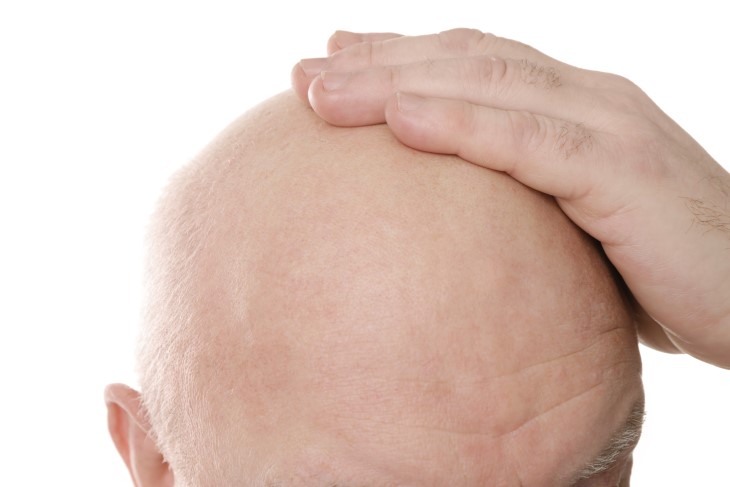 head bald skin treatment