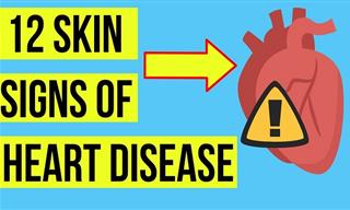 Your Skin & Nails Might Be Telling You About Heart Health