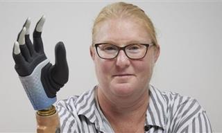 New Bionic Arm Fuses With Woman's Nerves