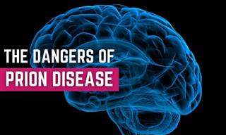 Prion Disease - the Infectious Disease Few People Know