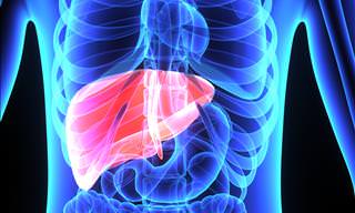 The Symptoms of a Fatty Liver and How to Treat it!