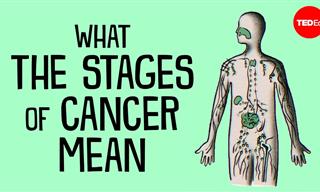 Stages of Cancer: What Do the Stages & Grades Mean?