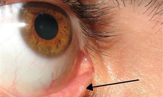 These Are the Body Parts You Didn't Even Know You Had