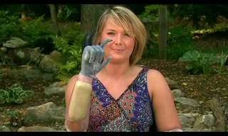 The Incredible Bionic Hands of Aimee Copeland