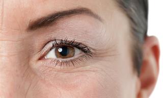 10 Natural Ways to Get Rid Of Eye Wrinkles