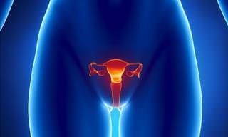 What is the Cause of Polycystic Ovary Syndrome?