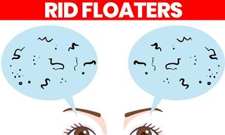 What are Eye Floaters and How Do I Get Rid of Them?