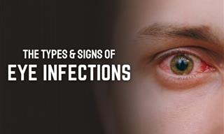 Guide to Eye Infections - Types, Causes, Worrying Symptoms