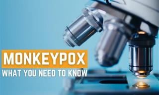 Monkeypox - What It Is and What You Need to Know