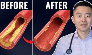 The Best Meal Designed to Clean Your Arteries