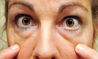 8 Tips to Get Rid of Bags Under Your Eyes