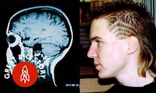 A Brutal Attack Turned This Man into a Math Genius