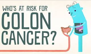 Learn Whether You're at High Risk of Colon Cancer