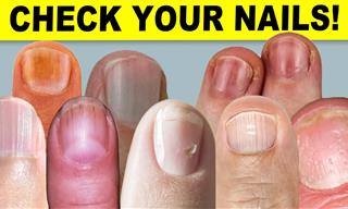 9 Things Your Fingernails Can Tell You About Your Health