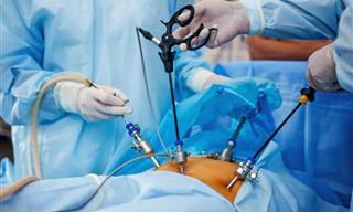 A Guide to Laparoscopy Surgery