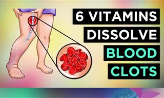 6 Vitamins for Getting Rid of Blood Clots