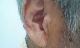 Did You Know Your Ears Hold Secrets About Your Heart?