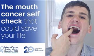 Here’s How to Do a Self Oral Cancer Check
