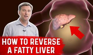 Dr. Berg Explains How You Can Heal Your Fatty Liver