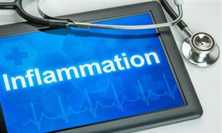 Health Quiz: What Do You Know About Inflammation?