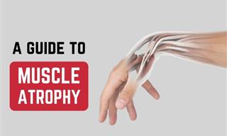 Muscle Atrophy: Types, Signs and Ways to Reverse It