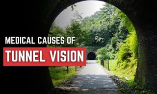 5 Serious Medical Causes of Tunnel Vision