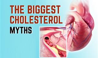6 Things We All Get Wrong About Cholesterol