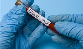 Understanding Your Blood Test Results in Plain Language