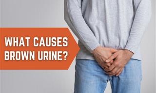 Is Brown Urine a Cause For Concern? Yes, Sometimes