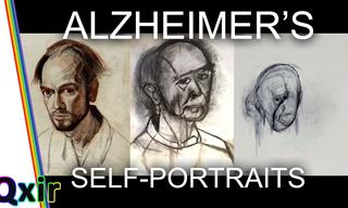 Watch This Alzheimer’s Progression Through Self Portraits