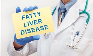 New Study Shows Effect of Diet Drugs on Fatty Liver Disease
